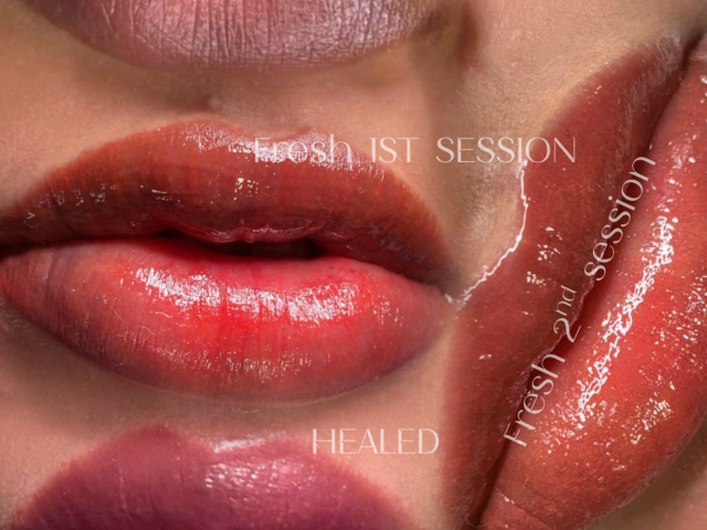 dark lip neutralization in waterloo kitchener