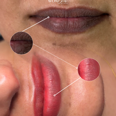 dark lip neutralization near me in waterloo and kitchener